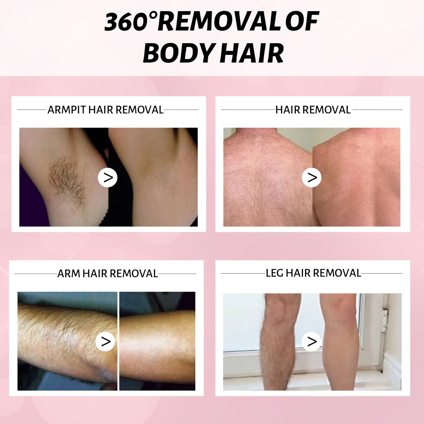 Hair Removal Spray for Women & Men – Gentle Foam for Legs, Armpits, 30ml/100ml